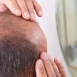 The Science Behind FUT Hair Restoration Explained Simply